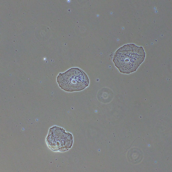 Фазово-контрастное устройство MAGUS PH2