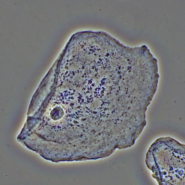 Фазово-контрастное устройство MAGUS PH2