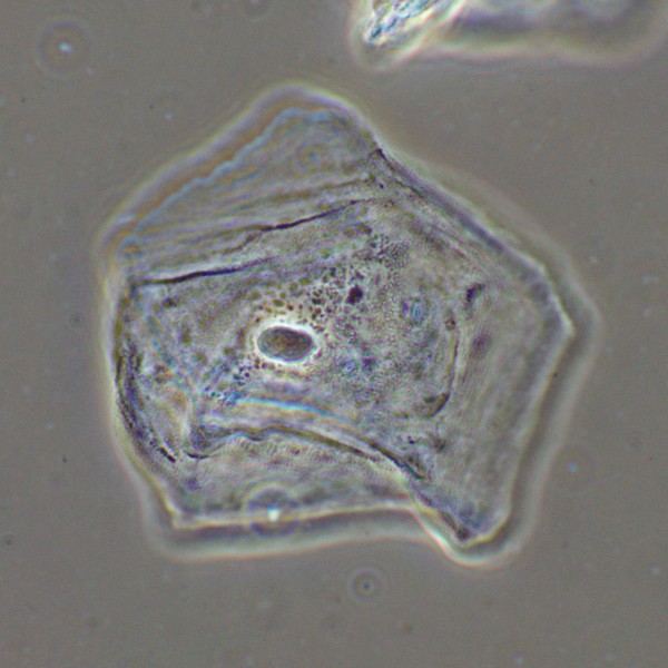 Фазово-контрастное устройство MAGUS SPH2