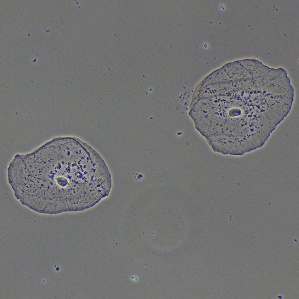 Фазово-контрастное устройство MAGUS PH2