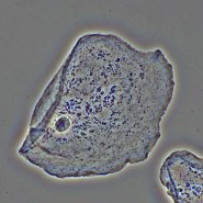 Фазово-контрастное устройство MAGUS PH2