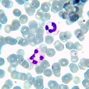 Микроскоп биологический цифровой MAGUS Bio D230TL