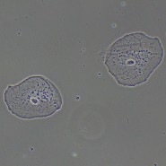 Фазово-контрастное устройство MAGUS PH2